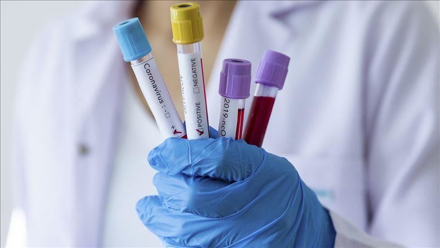 U BiH 1.633 novozaraženih, preminulo 47 osoba